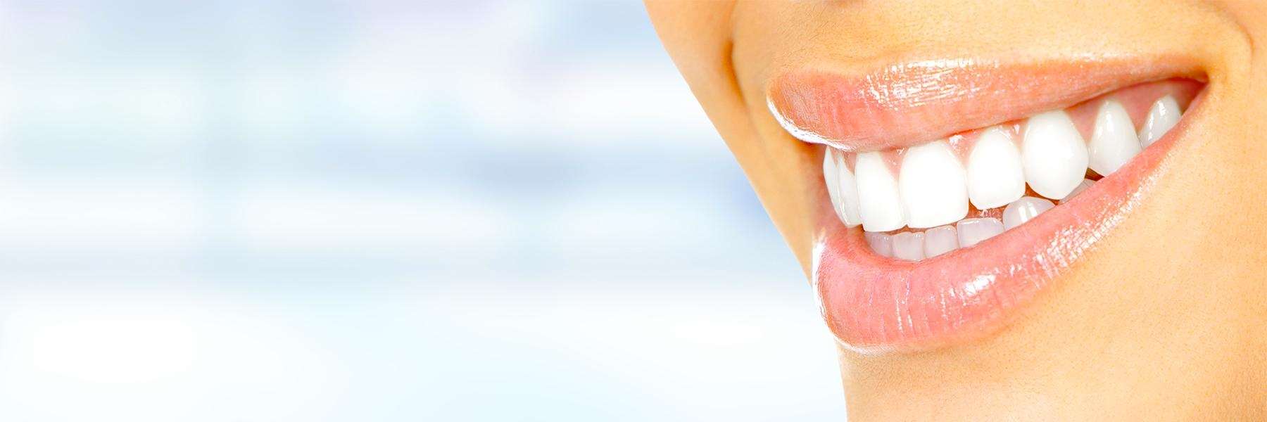 close up of bright smile | general dentist clifton hill