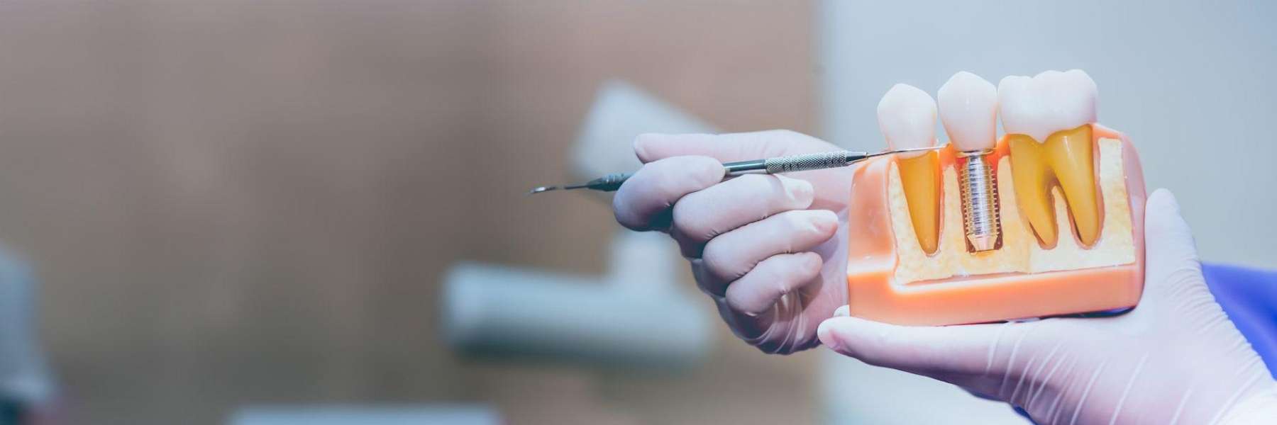 A dentist showing a dental implant model to a patient