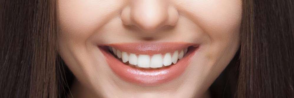 A smiling woman with straight and white teeth