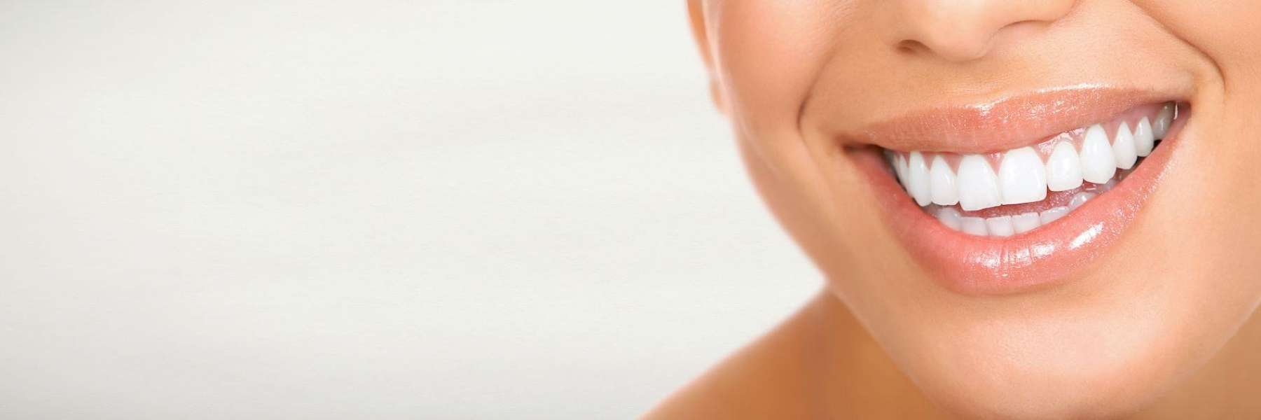 A smiling woman with white teeth
