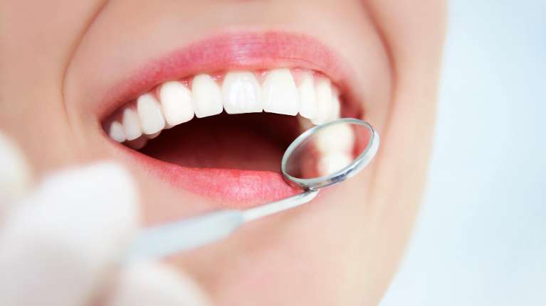 A smiling woman getting a dental exam with a dental mirror